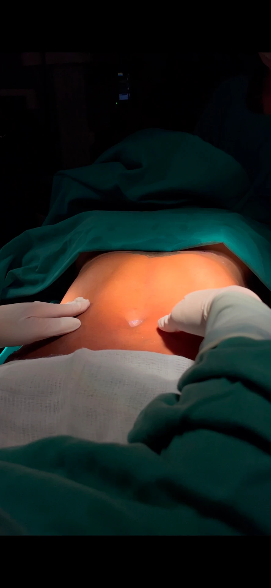 Avaliação cuidadosa durante a cirurgia